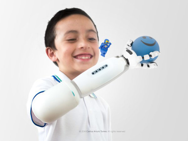 Carlos Arturo Torres LEGO prosthetics